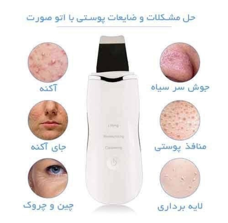 دستگاه اتو صورت اولترا سونیک با تمرکز بر استفاده آسان و نتیجه طبیعی در گروه مراقبت از پوست