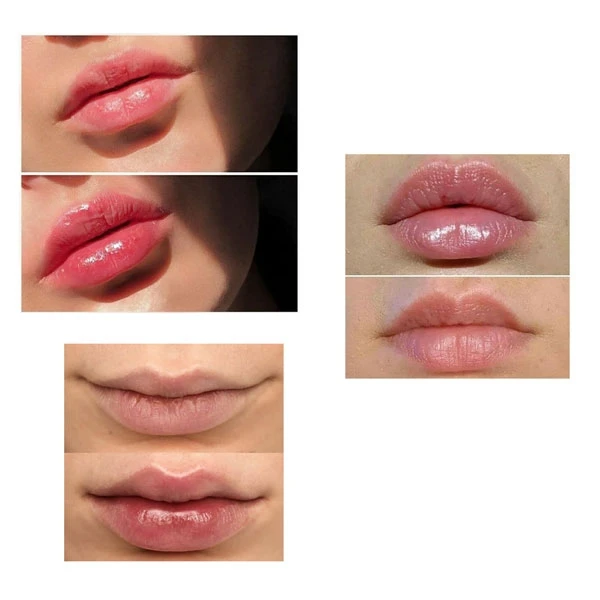 حجم دهنده لب اورجینال PLUMP IT؛ گزینه‌ای مناسب برای تکمیل روتین زیبایی در گروه حجم دهنده لب؛ نمای شماره 4