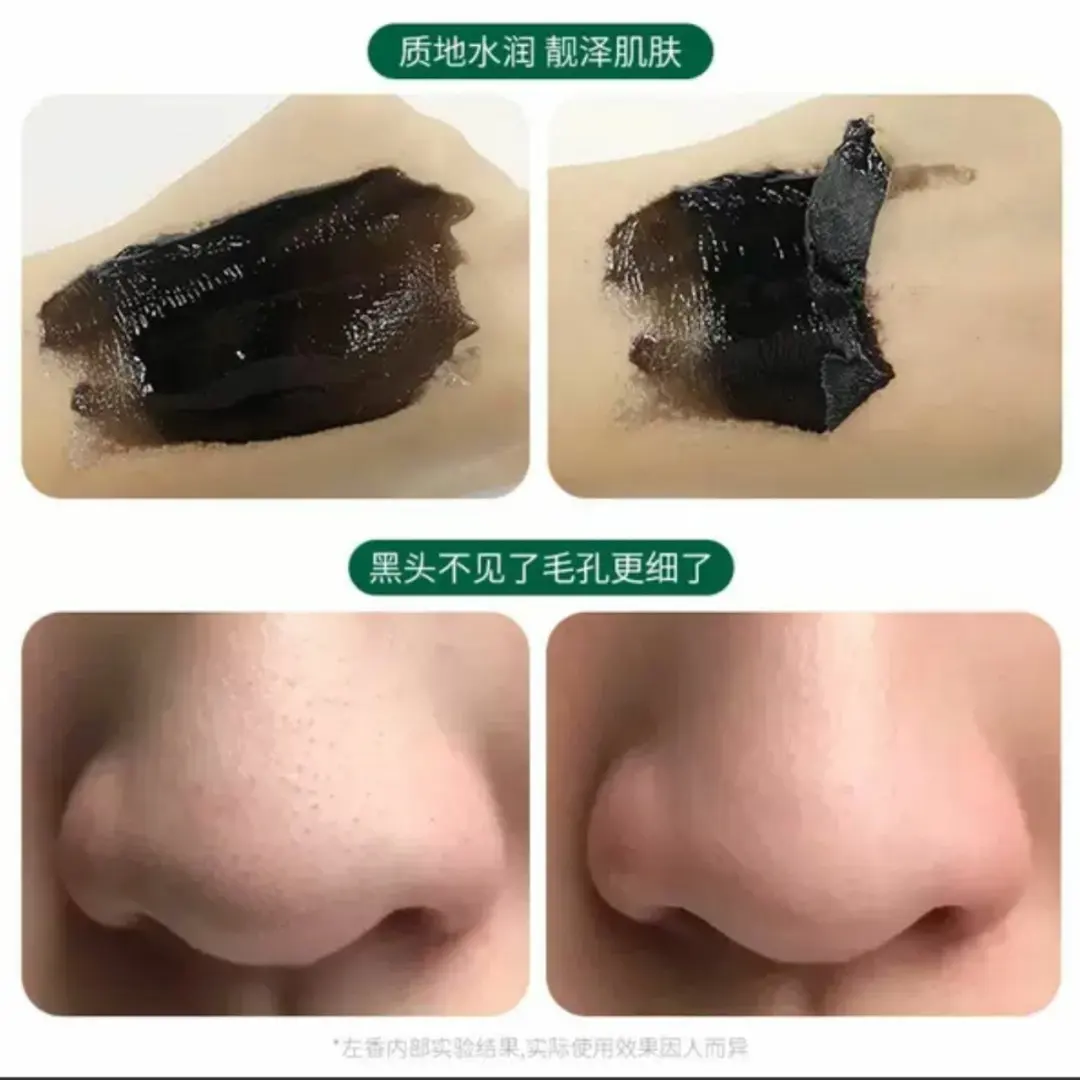 بلک ماسک سالیسیلیک اسید زوسون؛ انتخاب کاربردی برای روتین روزانه در گروه ضدجو‌ش؛ نمای شماره 3