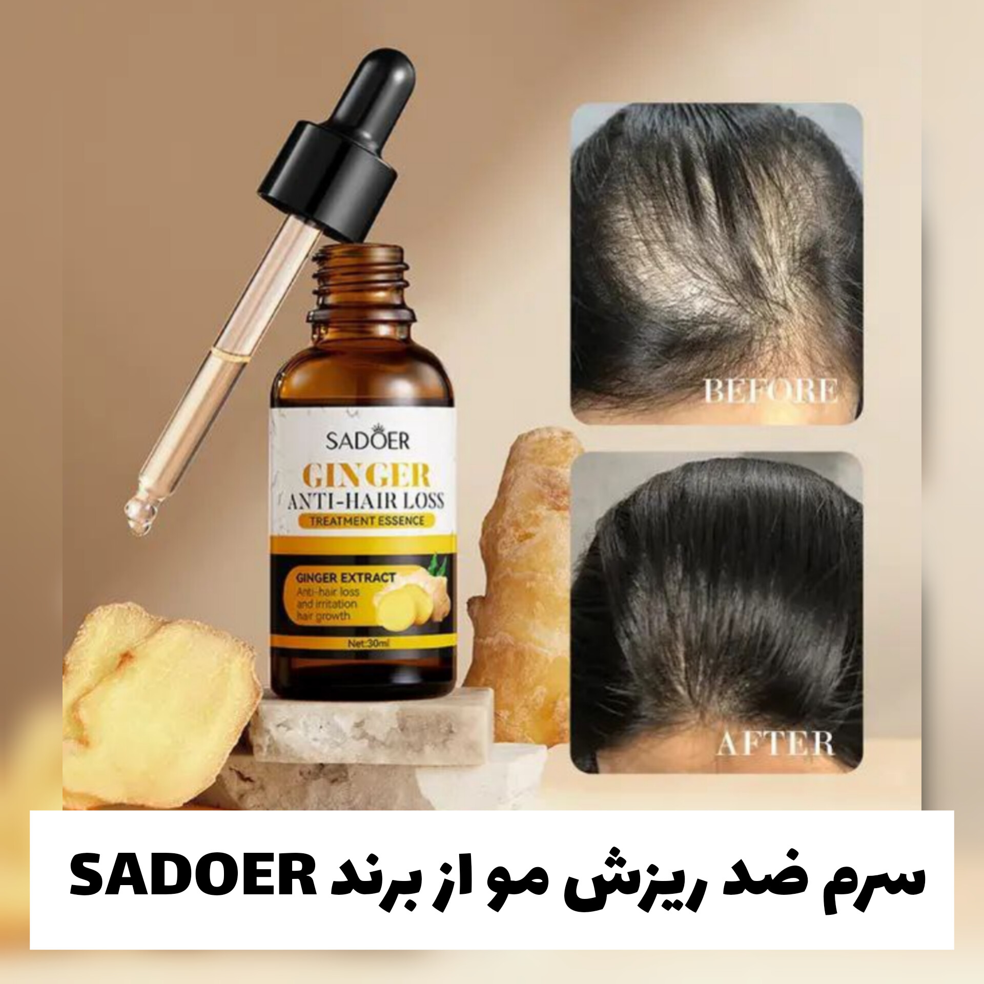 سرم ضد ریزش مو از برند سادور Sadoer با تمرکز بر استفاده آسان و نتیجه طبیعی در گروه مراقبت از پوست