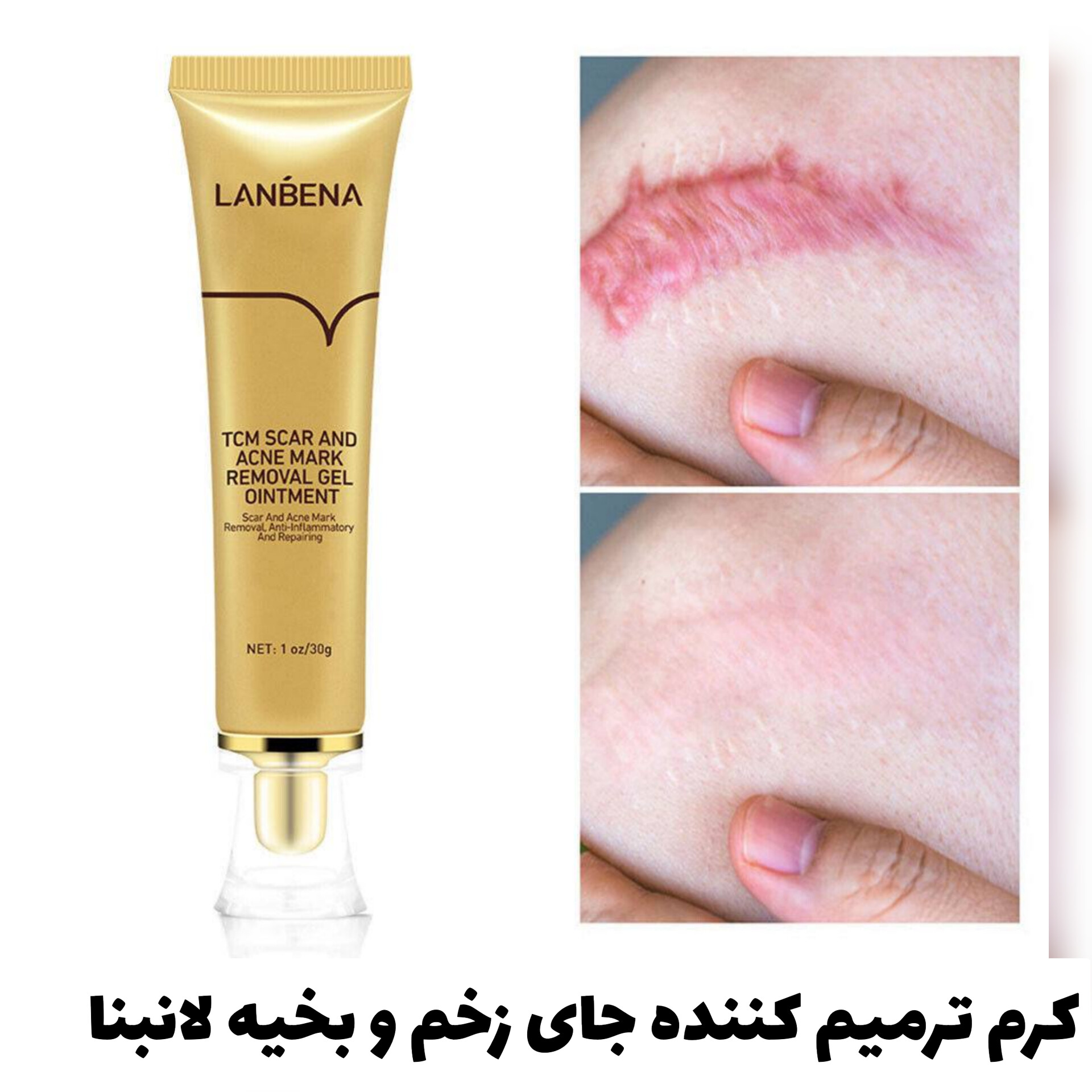 کرم ترمیم کننده جای زخم و بخیه لانبنا؛ انتخابی متناسب با مراقبت و زیبایی روزمره در گروه مراقبت از پوست