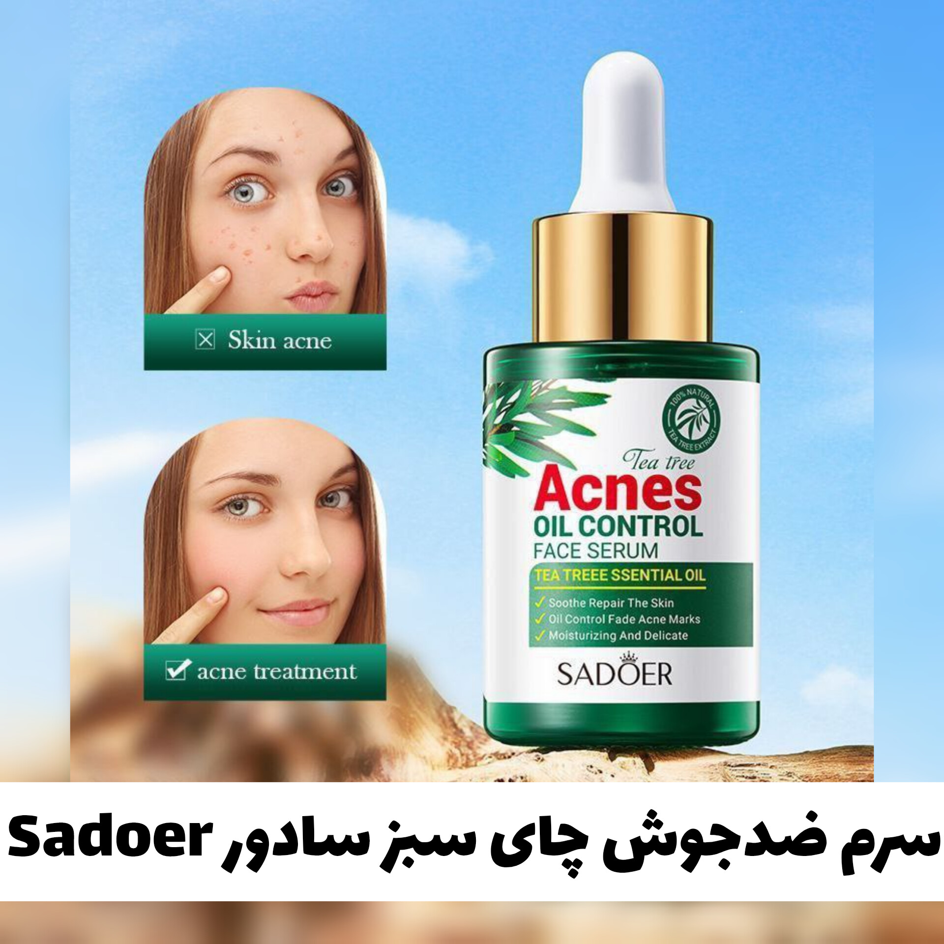 سرم ضدجوش چای سبز سادور Sadoer با معرفی دقیق ویژگی‌ها و کاربرد در گروه ضدجو‌ش
